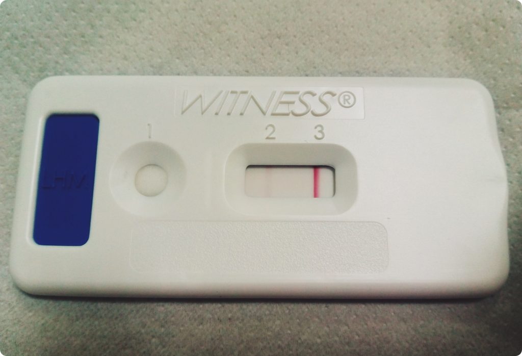 test leishmania